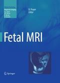 Fetal MRI