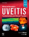 Whitcup and Nussenblatt’s Uveitis
