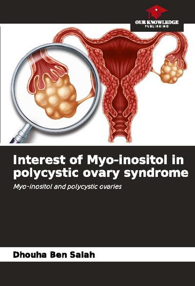 Interest of Myo-inositol in polycystic ovary syndrome