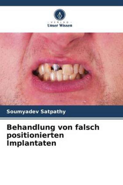 Behandlung von falsch positionierten Implantaten