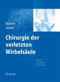 Chirurgie der verletzten Wirbelsäule