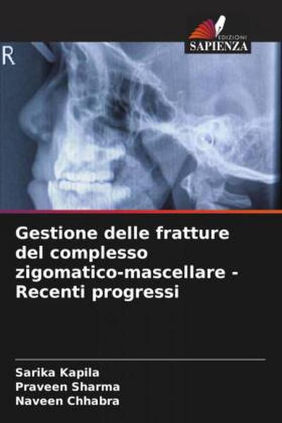 Gestione delle fratture del complesso zigomatico-mascellare - Recenti progressi