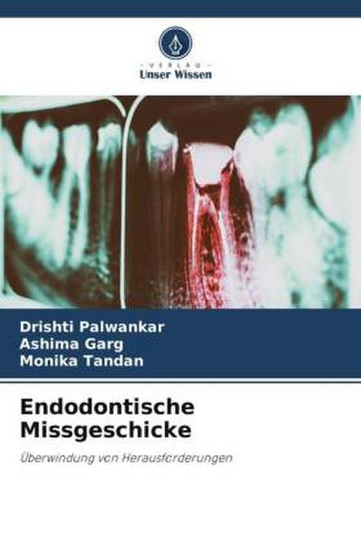 Endodontische Missgeschicke