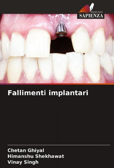 Fallimenti implantari