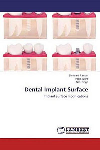 Dental Implant Surface