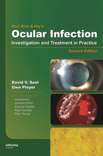 Ocular Infection