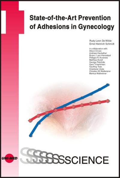 State-of-the-Art Prevention of Adhesions in Gynecology