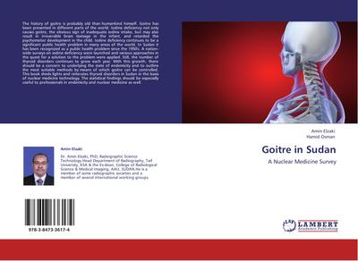 Goitre in Sudan