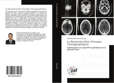 La Reconstruction d’images Tomographiques