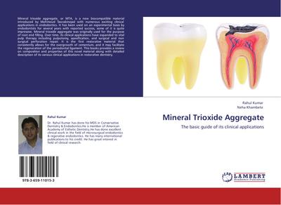 Mineral Trioxide Aggregate