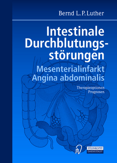 Intestinale Durchblutungsstörungen