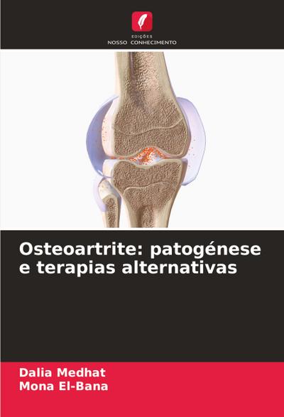 Osteoartrite: patogénese e terapias alternativas