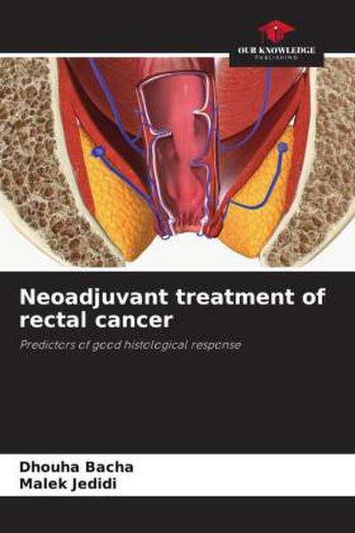 Neoadjuvant treatment of rectal cancer