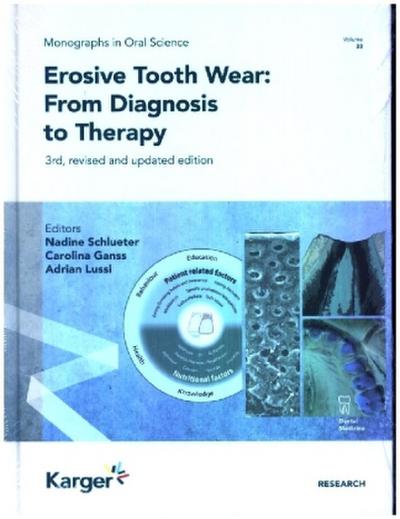 Erosive Tooth Wear: From Diagnosis to Therapy