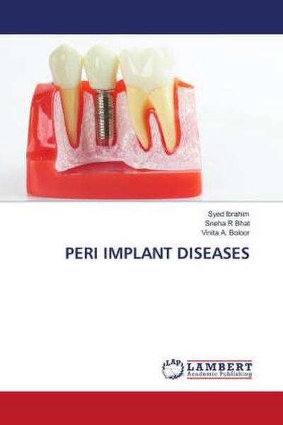 PERI IMPLANT DISEASES