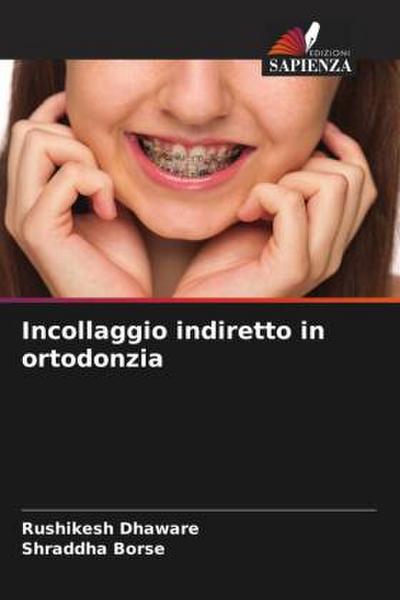 Incollaggio indiretto in ortodonzia