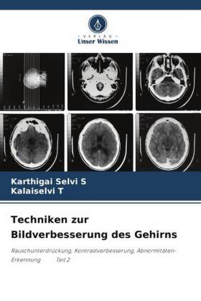 Techniken zur Bildverbesserung des Gehirns