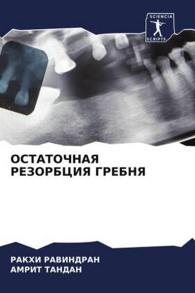 OSTATOChNAYa REZORBCIYa GREBNYa