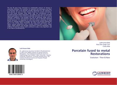 Porcelain fused to metal Restorations