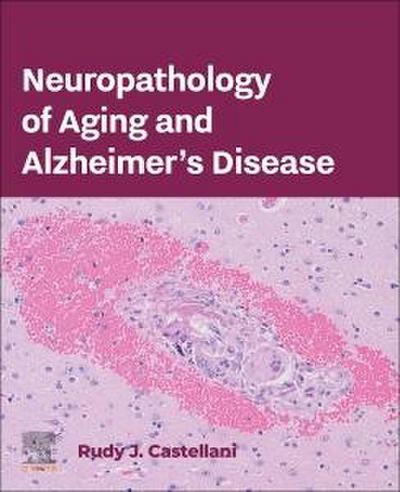 Neuropathology of Aging and Alzheimer’s Disease