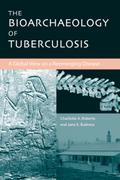 The Bioarchaeology of Tuberculosis