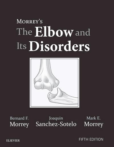 Morrey’s The Elbow and Its Disorders E-Book
