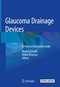 Glaucoma Drainage Devices