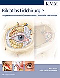 Bildatlas Lidchirurgie