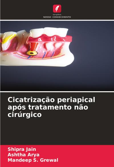 Cicatrização periapical após tratamento não cirúrgico