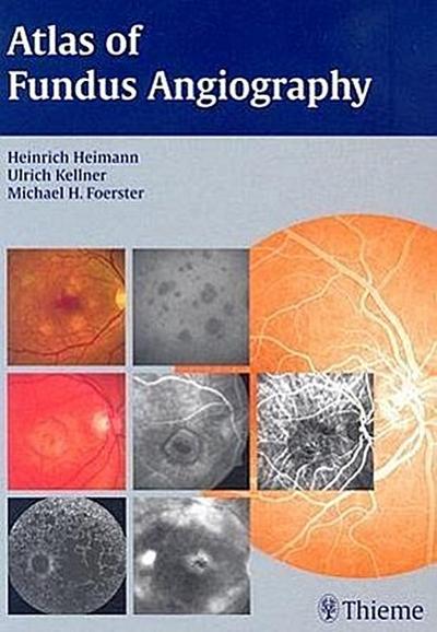 Atlas of Fundus Angiography