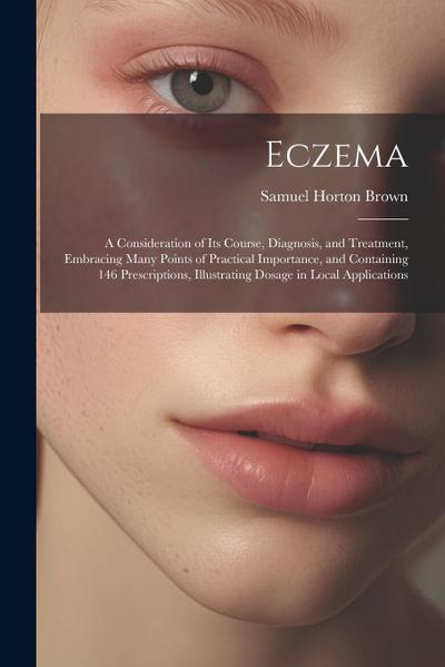 Eczema: A Consideration of Its Course, Diagnosis, and Treatment, Embracing Many Points of Practical Importance, and Containing