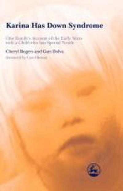 Karina Has Down Syndrome