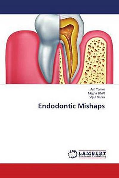 Endodontic Mishaps