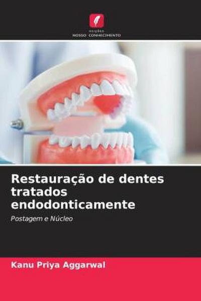 Restauração de dentes tratados endodonticamente
