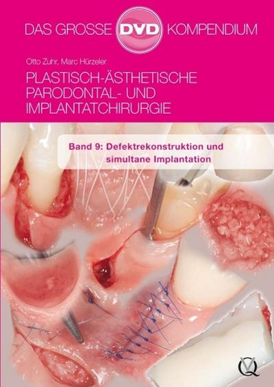 Plastisch-Ästhetische Parodontal- und Implantatchirurgie