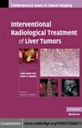 Interventional Radiological Treatment of Liver Tum