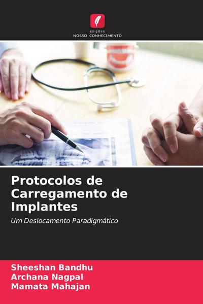 Protocolos de Carregamento de Implantes