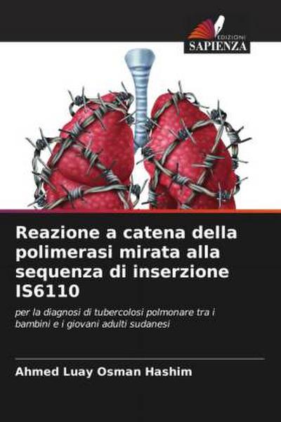 Reazione a catena della polimerasi mirata alla sequenza di inserzione IS6110