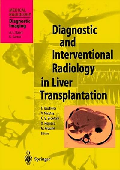 Diagnostic and Interventional Radiology in Liver Transplantation