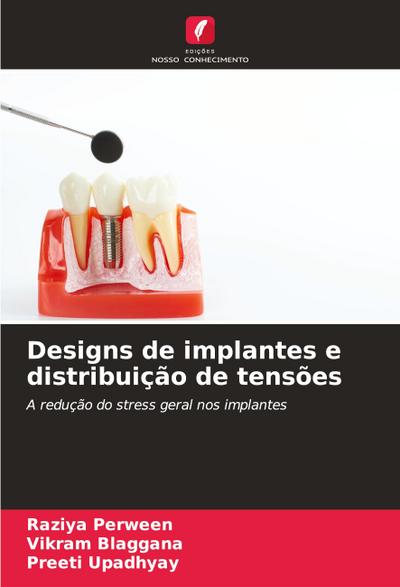 Designs de implantes e distribuição de tensões