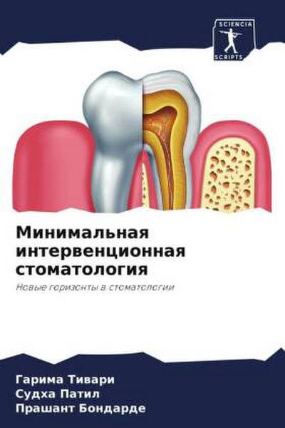 Minimal’naq interwencionnaq stomatologiq