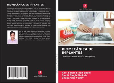 BIOMECÂNICA DE IMPLANTES
