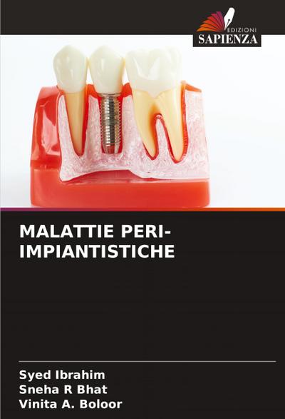 MALATTIE PERI-IMPIANTISTICHE