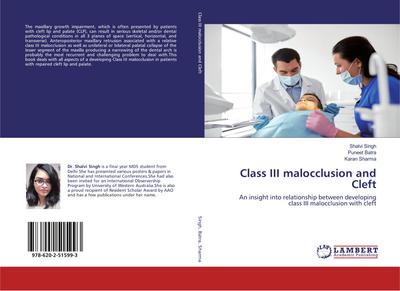 Class III malocclusion and Cleft