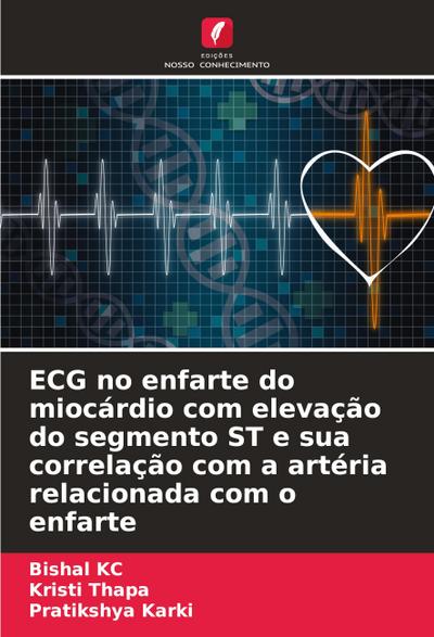 ECG no enfarte do miocárdio com elevação do segmento ST e sua correlação com a artéria relacionada com o enfarte