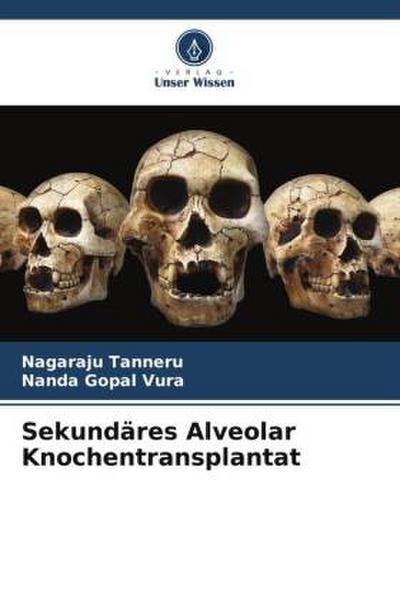 Sekundäres Alveolar Knochentransplantat