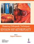 Mastering Orthopedic Techniques