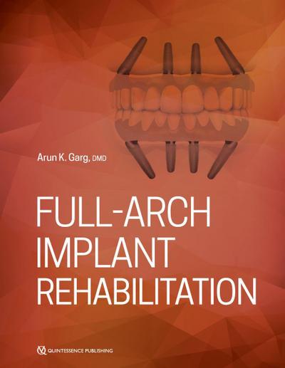 Full-Arch Implant Rehabilitation (eBook, PDF) - Arun Garg