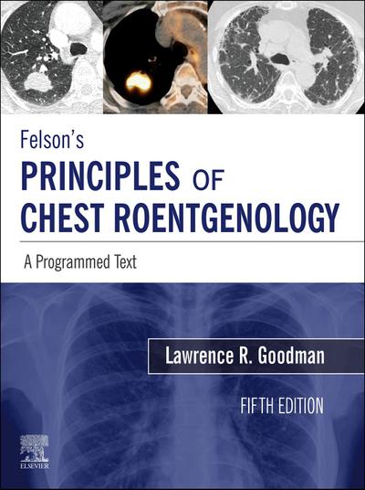 Felson’s Principles of Chest Roentgenology E-Book