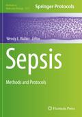 Sepsis